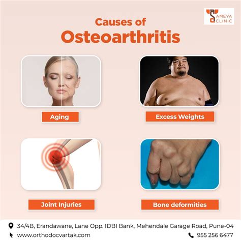 Osteoarthritis Causes
