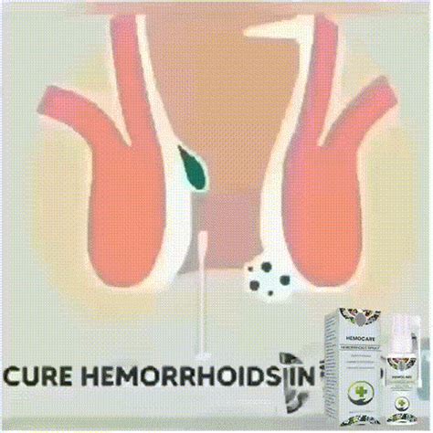 Hemocare Herbal Hemorrhoids Spray