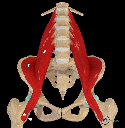 Iliopsoas Tendon Release