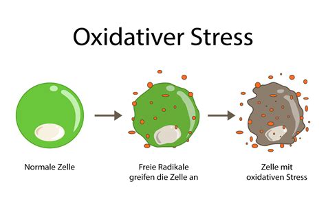 Parkinson Oxidativer Stress Gesundheitsratgeber Mein Tag