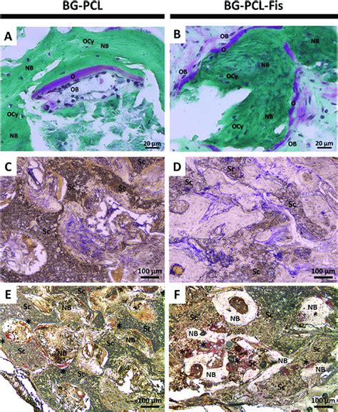 Histological Staining Of Frontal Demineralized Tissue Sections Of