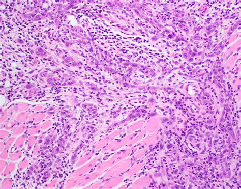 Oropharynx Histology