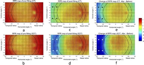 Figure 1 From Two Dimensional Peripheral Refraction And Retinal Image