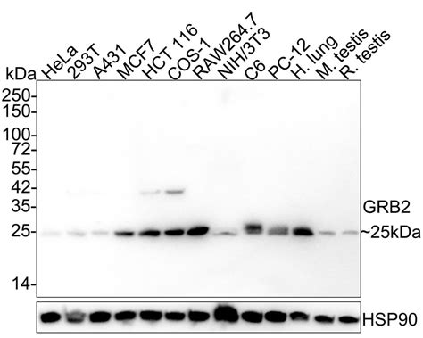 GRB2 Recombinant Rabbit Monoclonal Antibody JE49 73 HA721923 HUABIO