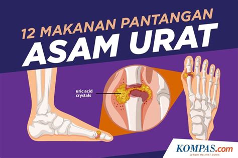 Infografik Makanan Pantangan Asam Urat