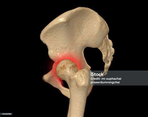 Ct Scan Of Pelvic Bone And Hip Joint 3d Rendering For Diagnosis