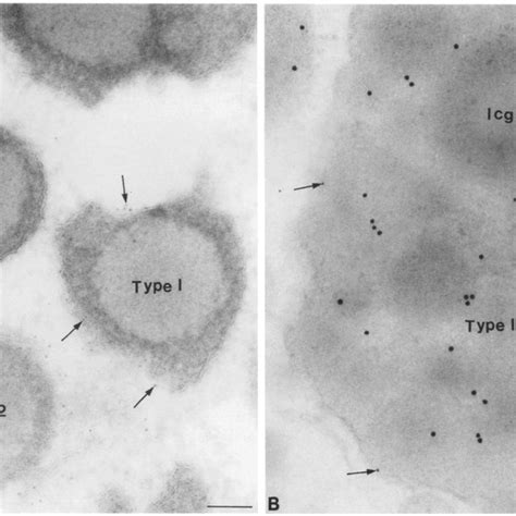 Double Immunogold Labeling For The Lysosomal Marker Lgpl Nm