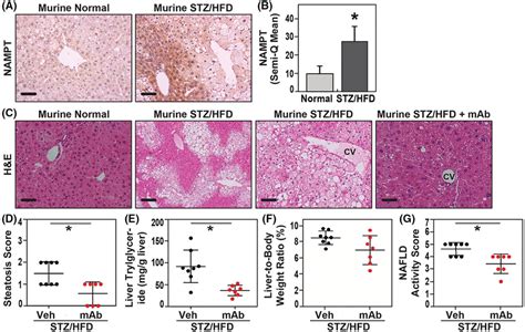 Role Of Enampt In Preclinical Murine Model Of Stzhfd‐induced Hepatic