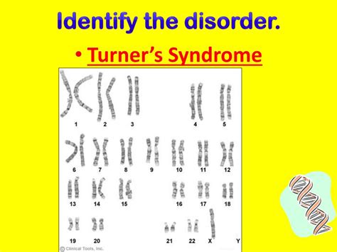 Ppt Patterns Of Heredity Review Powerpoint Presentation Free Download Id1985601