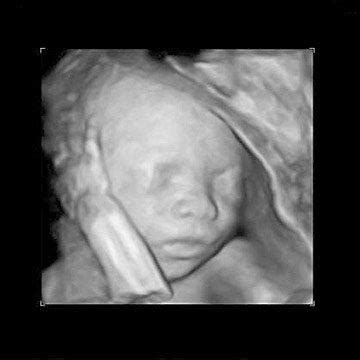 Ultrasound Pictures Week By Week: Your Second Trimester