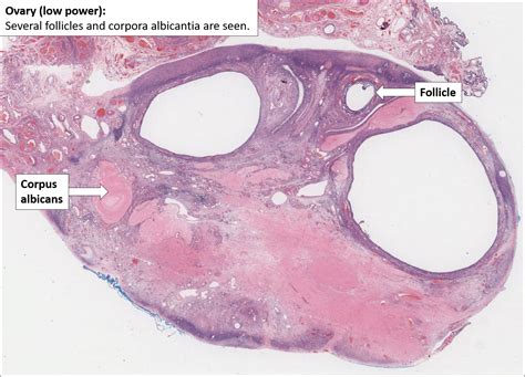 Ovary Normal Histology Nus Pathweb Nus Pathweb