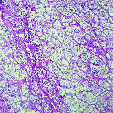 Histopathological Examination And Immunohistochemistry Staining Download Scientific Diagram