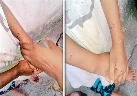 Shocking Stepfather Mother Brand Minor Girl With Hot Iron In Pune India News India TV