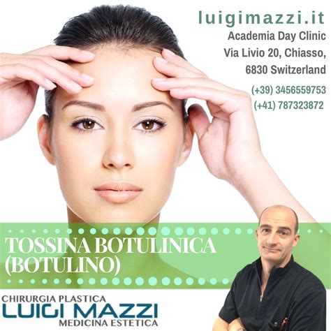 Dr Luigi Mazzi Tossina Botulinica Botulino Vie Le Rughe Dalla