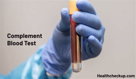 Complement Blood Test Types Purpose Preparation And Results