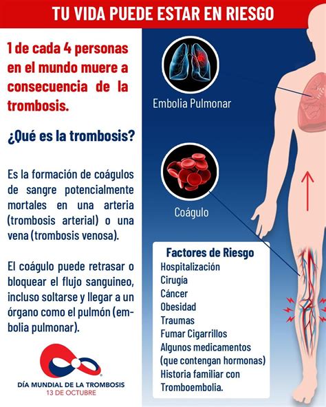 Trombosis La Desconocida Enfermedad Que Mata Una Persona Cada Seis