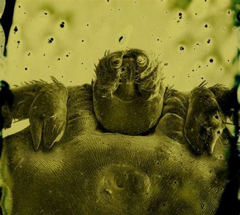 Photographer Captures Mesmeric Images Of Parasitic Worm Sex Mannaismaya Adventure S Blog