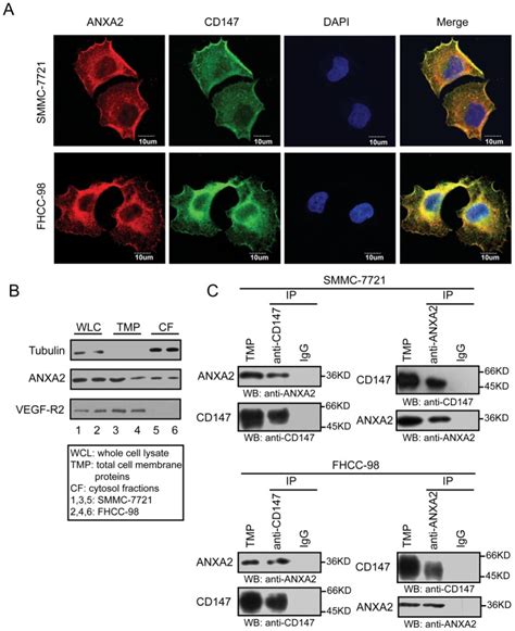 A Expression And Localization Of Anxa And Cd In Hcc Cells