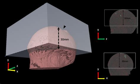 ROI Of The Femoral Head When BMD Was Directly Measured With Micro CT A