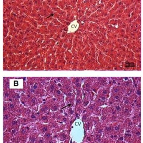 Histological Examination Of Nc Rat Livers Stained With A Haematoxylin