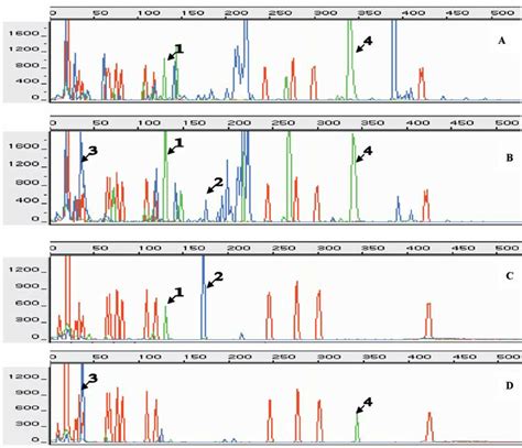 T Rflps Of Alu I Restriction Digested 16s Rdna To Assess The Bacterial