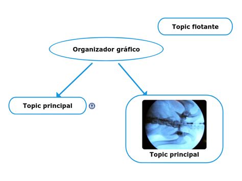 Organizador gráfico Mind Map