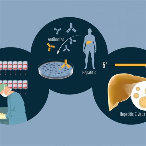 Premio Nobel De Medicina Al Descubrimiento Del Virus De La Hepatitis C