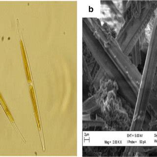 Fluorescence Micrograph A And Scanning Electron Micrograph B Of