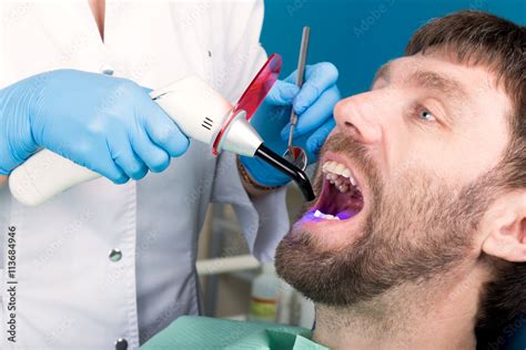 Doctor Examines The Oral Cavity On Tooth Decay Caries Protection