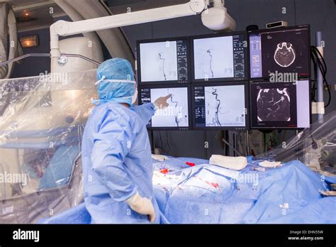 Cerebral Angiography Procedure