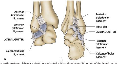 Figure 4 From Imaging Of Impingement Lesions In The Ankle Semantic