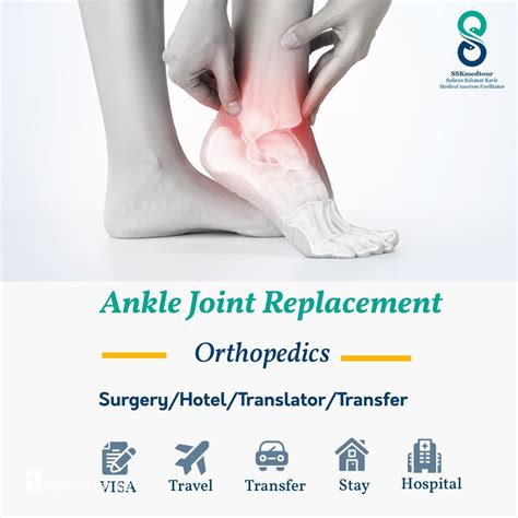 Ankle Joint Replacement - Safiran Salamat Kavir