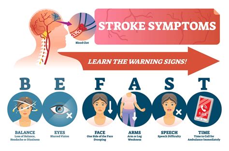Acupuncture Potentially Reduces Stroke Risk in Rheumatoid Arthritis