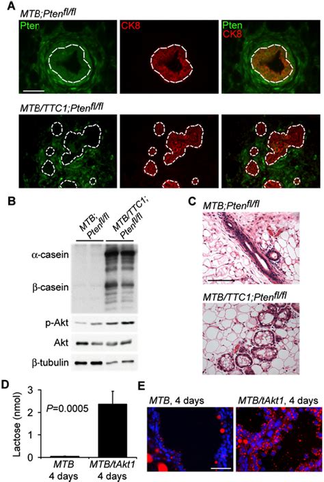 Figure From Autocrine Prolactin Induced By The Pten Akt Pathway Is