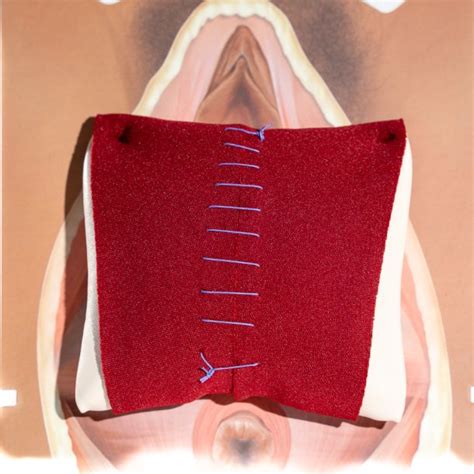 Rectovaginal Fascia Palpation And Repair Model Perineal Repair