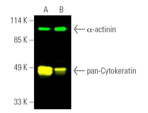 Anti-pan-Cytokeratin Antibody (C11) | SCBT - Santa Cruz Biotechnology