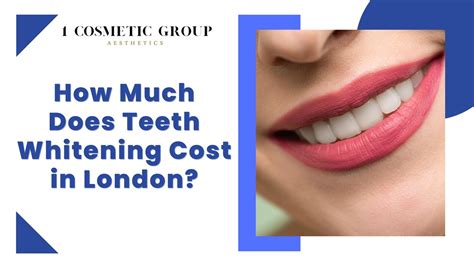 Ppt How Much Does Teeth Whitening Cost In London Powerpoint