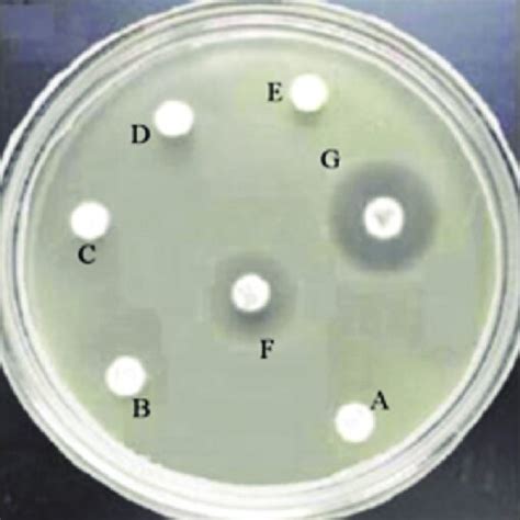 Inhibition Zone Of Streptomyces Spp Extract Against Mycobacterium