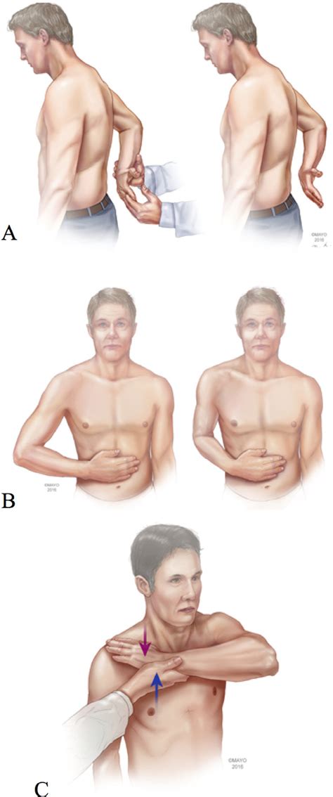 Subscapularis physical examination maneuvers. (A) Lift-off test. (B ...