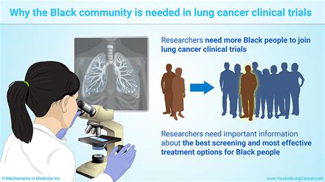 Slide Show Lung Cancer Clinical Trials And The Us Black Community