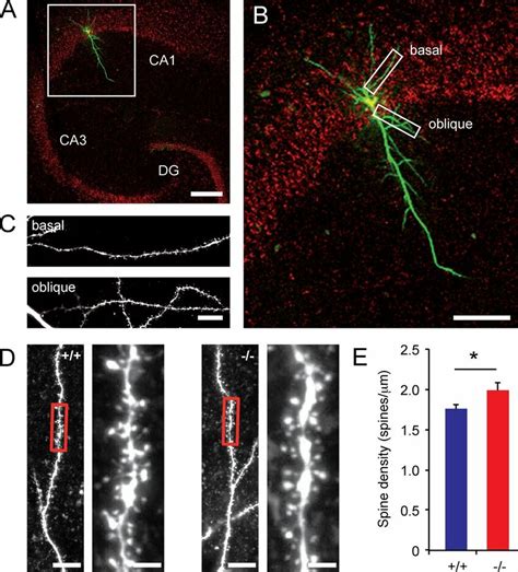 Hippocampal Spine Densities Are Increased In Trim3 Mice A Example