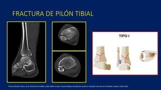 Clase De Fracturas De Tobillo Radiologia Pptx