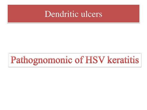 Ppt Fungal Keratitis Powerpoint Presentation Free Download Id8876972