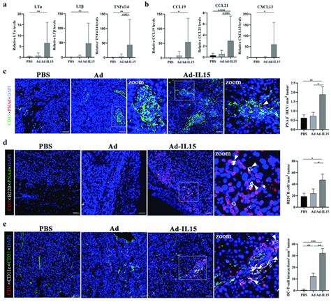 Intratumoral Injection Of Ad IL15 Induces Nonclassical TLS Formation