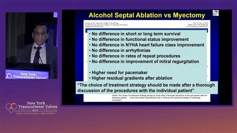 Alcohol Septal Ablation For HOCM Case Selection YouTube