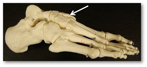 Foot (Medial View) Flashcards | Quizlet