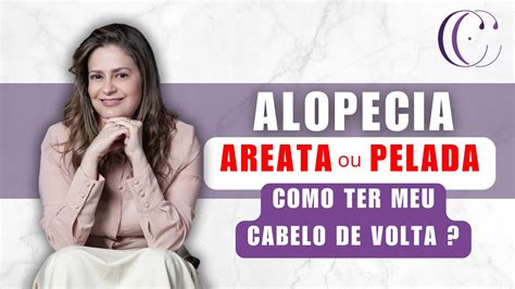 Alopecia Areata Ou Pelada Como Ter Meu Cabelo De Volta YouTube