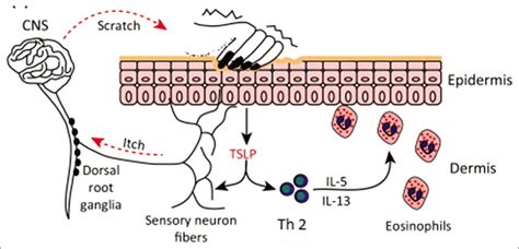 Pathogenesis Of Atopic Dermatitis Current Concepts Journal Of Skin