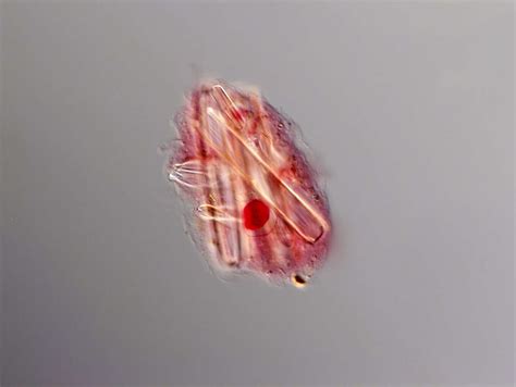 Amoeba Proteus Slide