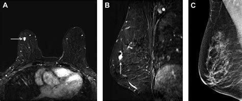 Duke Radiology Breast Imaging At Joseph Thompson Blog